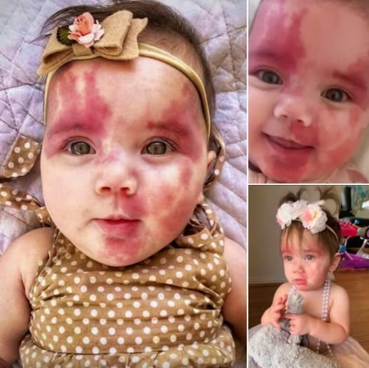 ¡Bebé llamada “Horrible” y “Defectuosa” sorprende a todos con su increíble transformación! ¡Mira las fotos!