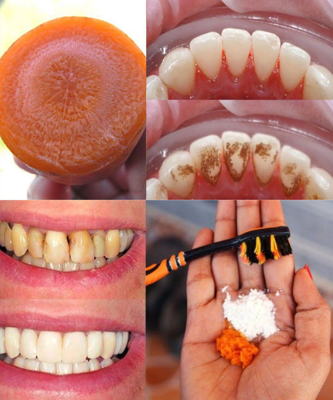 Come sbiancare i denti in 2 minuti?