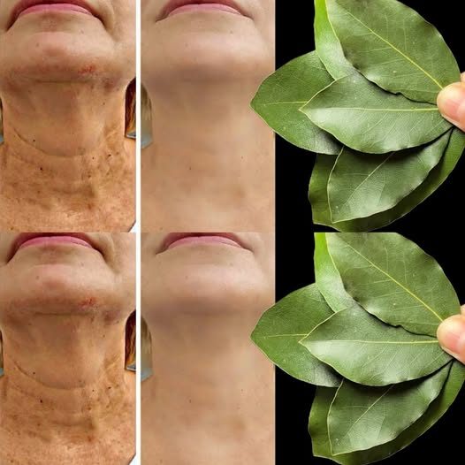 Il Botox è 100.000 volte più efficace? | Anche Natural Anti-Rough ha 70 anni!