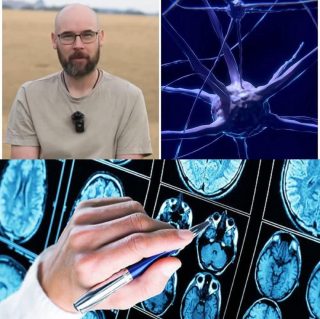 “Ho l’Alzheimer a 41 anni, è iniziato tutto quando mia…Altro…