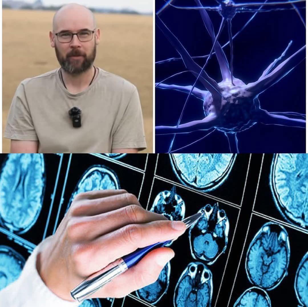“Ho l’Alzheimer a 41 anni, è iniziato tutto quando mia…Altro…
