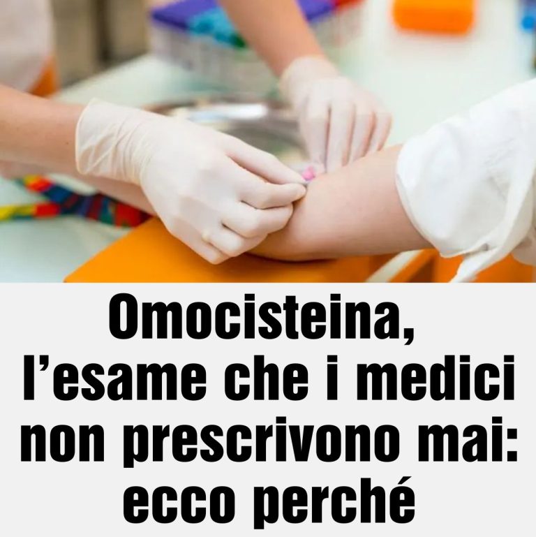 Omocisteina, l’esame che i medici non prescrivono mai: ecco perché