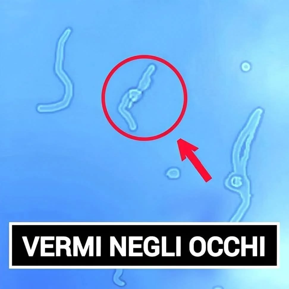 ⚠️ A tutti è capitato di vederli almeno una volta nella vita. Ecco svelato: “Son…Altro…