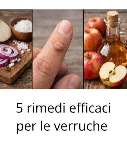 5 rimedi efficaci per le verruche