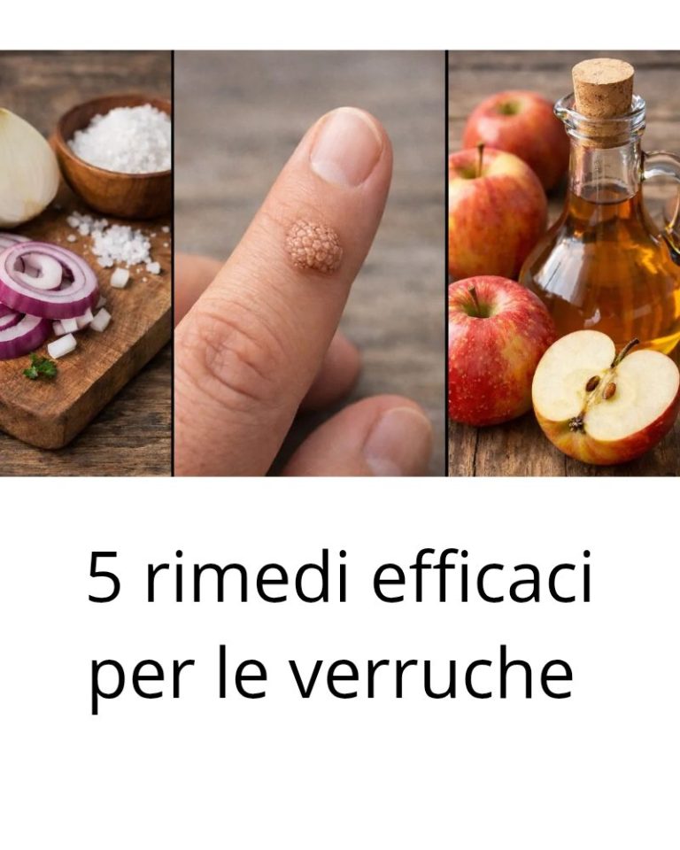 5 rimedi efficaci per le verruche